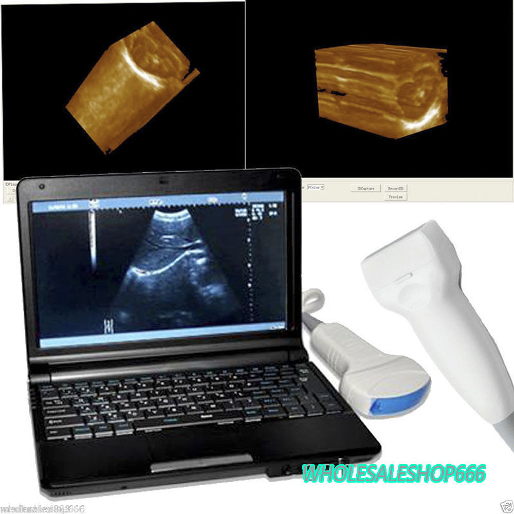 Digital Portable Notebook Laptop Ultrasound Machine Scanner+Convex+Linear Probe 190891866974 DIAGNOSTIC ULTRASOUND MACHINES FOR SALE