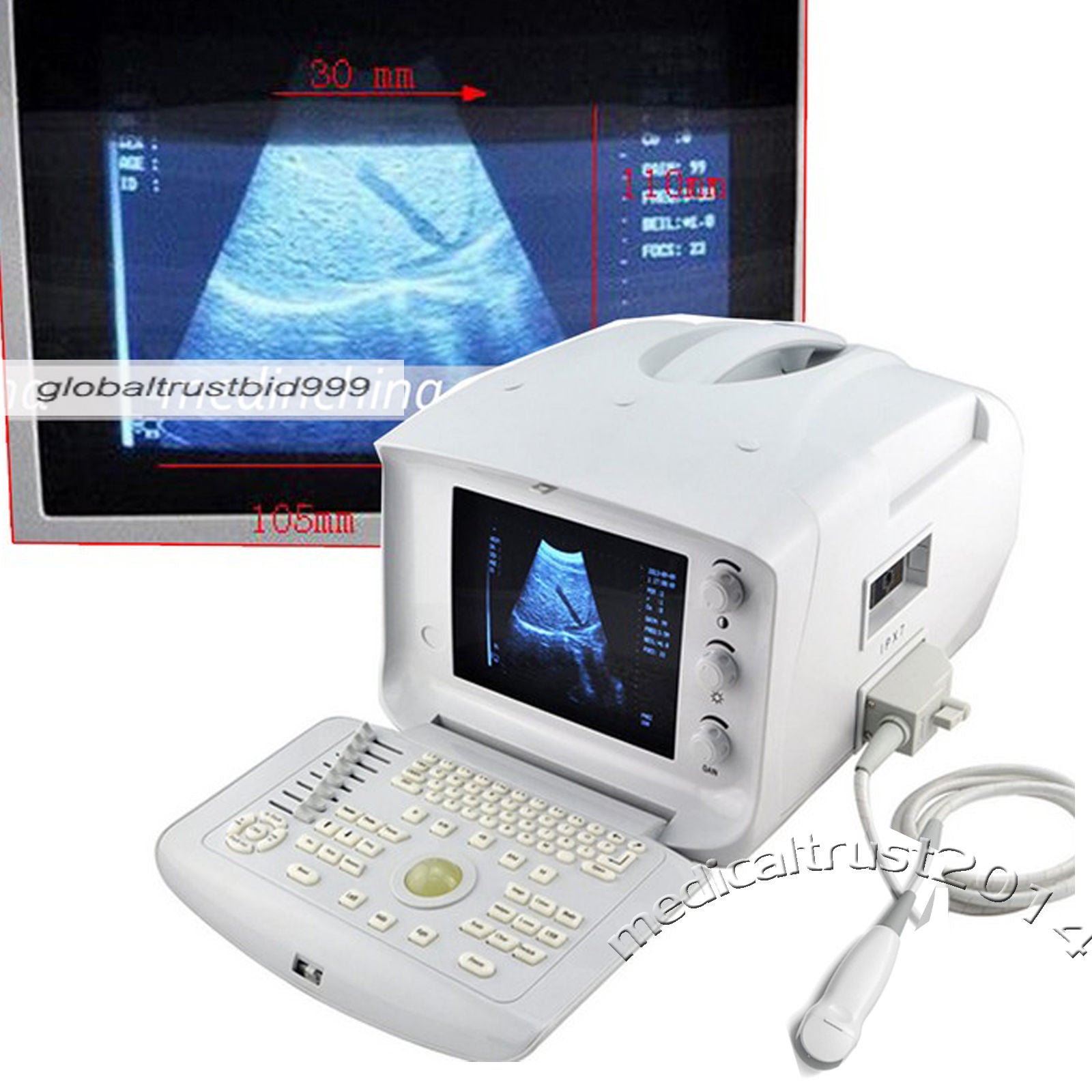 Top Ultrasound Scanner Machine Micro-Convex Probe w External 3D Clear Software DIAGNOSTIC ULTRASOUND MACHINES FOR SALE