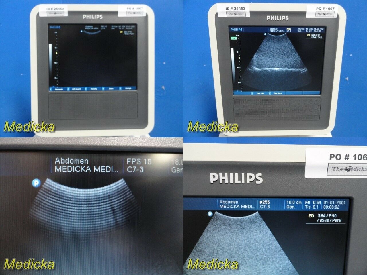 Philips HD3(HD3-Exp) Ultrasound System W/ C7-3 Convex Probe, Printer & PSU~25452 DIAGNOSTIC ULTRASOUND MACHINES FOR SALE