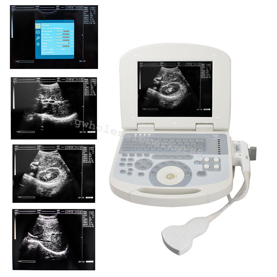 Ultrasound Machine Laptop Ultrasound Scanner Convex probe 3D Software Diagnose 190891045898 DIAGNOSTIC ULTRASOUND MACHINES FOR SALE