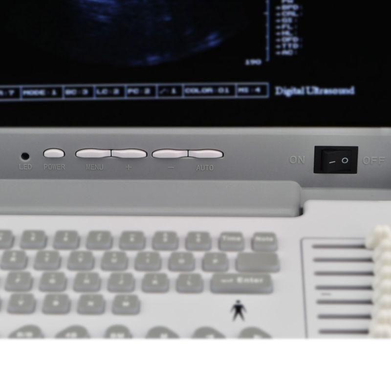 Full Digital Portable Ultrasound Scanner+Convex + Linear 2 Probes + 3D Brand New DIAGNOSTIC ULTRASOUND MACHINES FOR SALE