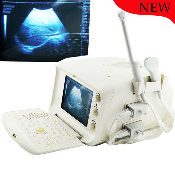 Portable Digital Ultrasound Scanner Machine CE, Convex + Transvaginal Probe 3D 190891052773 DIAGNOSTIC ULTRASOUND MACHINES FOR SALE