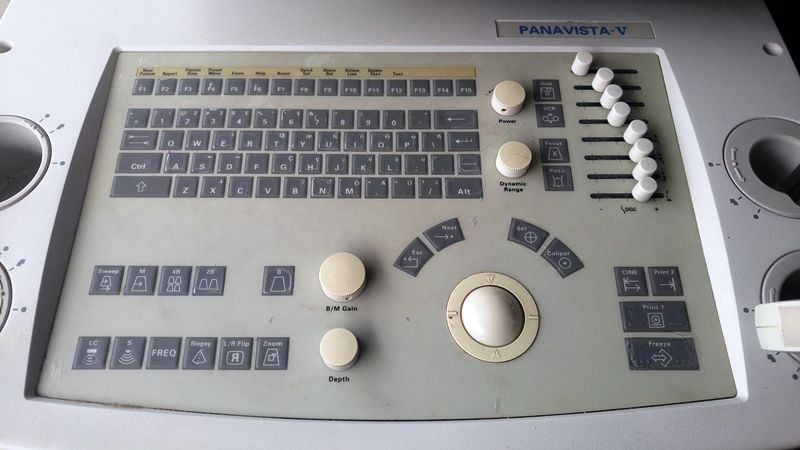 AAR 4175-PANASONIC PANAVISTA-V ULTRASOUND DIAGNOSTIC EQUIPMENT W/ CONVEX PROBE DIAGNOSTIC ULTRASOUND MACHINES FOR SALE