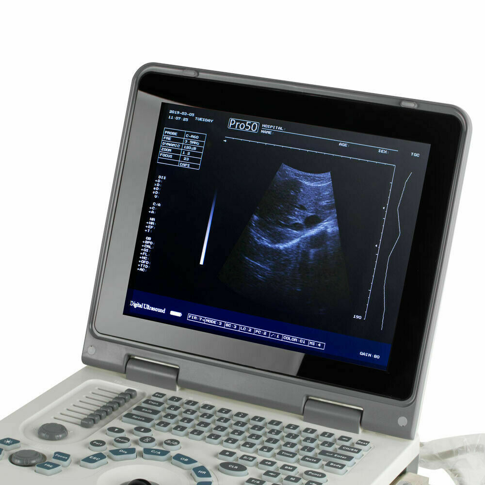 USA Full Digital Ultrasound Scanner Ultrasonic MachineDisgnos Convex Probe 3D CE DIAGNOSTIC ULTRASOUND MACHINES FOR SALE