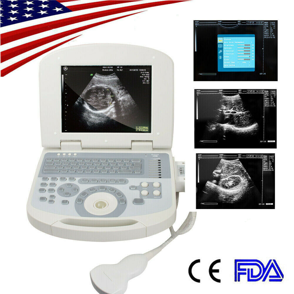 Medical Portable Notebook Digital Laptop Ultrasound Scanner Convex Probe+Free 3D DIAGNOSTIC ULTRASOUND MACHINES FOR SALE