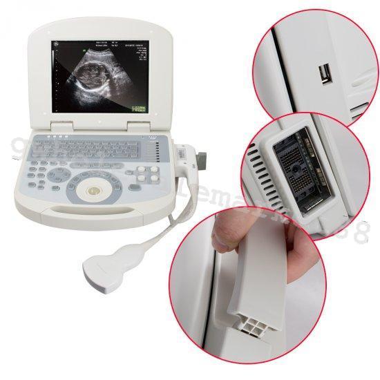 US Portable Digital Laptop Medical Ultrasound Scanner Machine Convex Probe 3D CE 190891422491 DIAGNOSTIC ULTRASOUND MACHINES FOR SALE