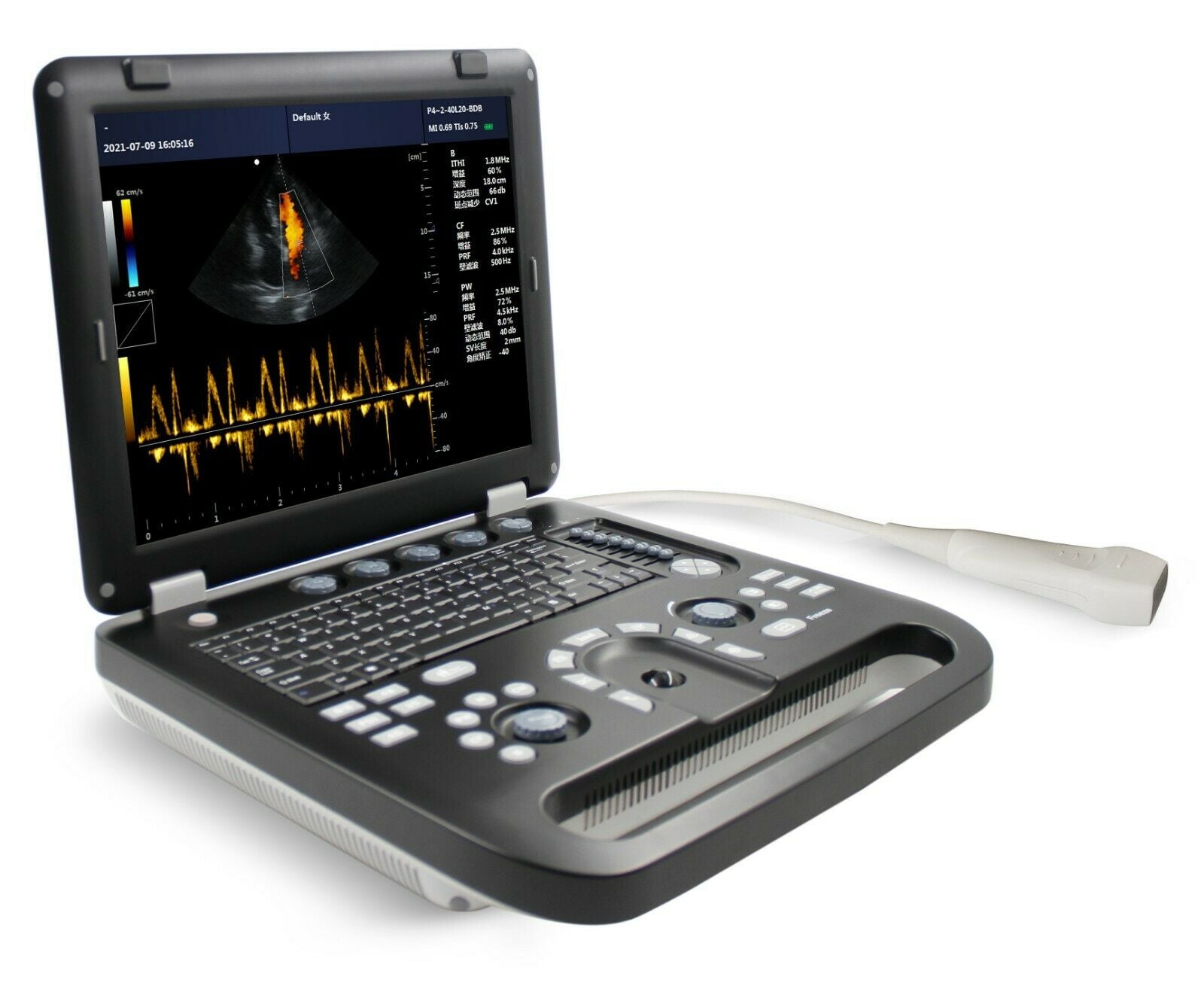 Portable Cardiac Heart Ultrasound Scanner Color Doppler Machine Phased Array PW DIAGNOSTIC ULTRASOUND MACHINES FOR SALE