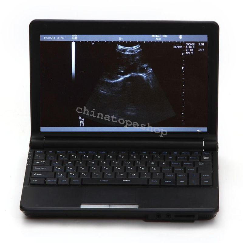 igital Laptop Notebook ultrasound scanner machine +Micro Convex probes Sale DIAGNOSTIC ULTRASOUND MACHINES FOR SALE