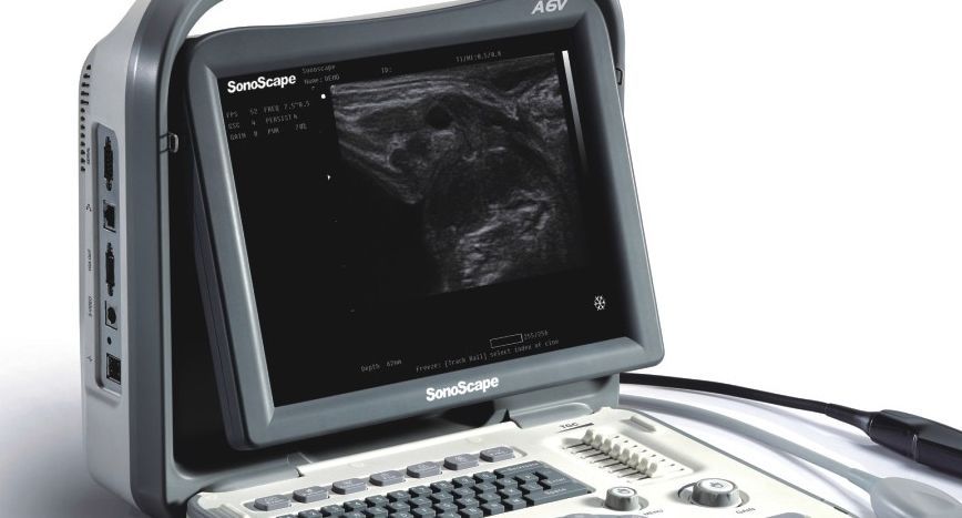 SonoScape A6V Portable Veterinary Ultrasound With 2 Probes: Rectal, Micro Convex DIAGNOSTIC ULTRASOUND MACHINES FOR SALE