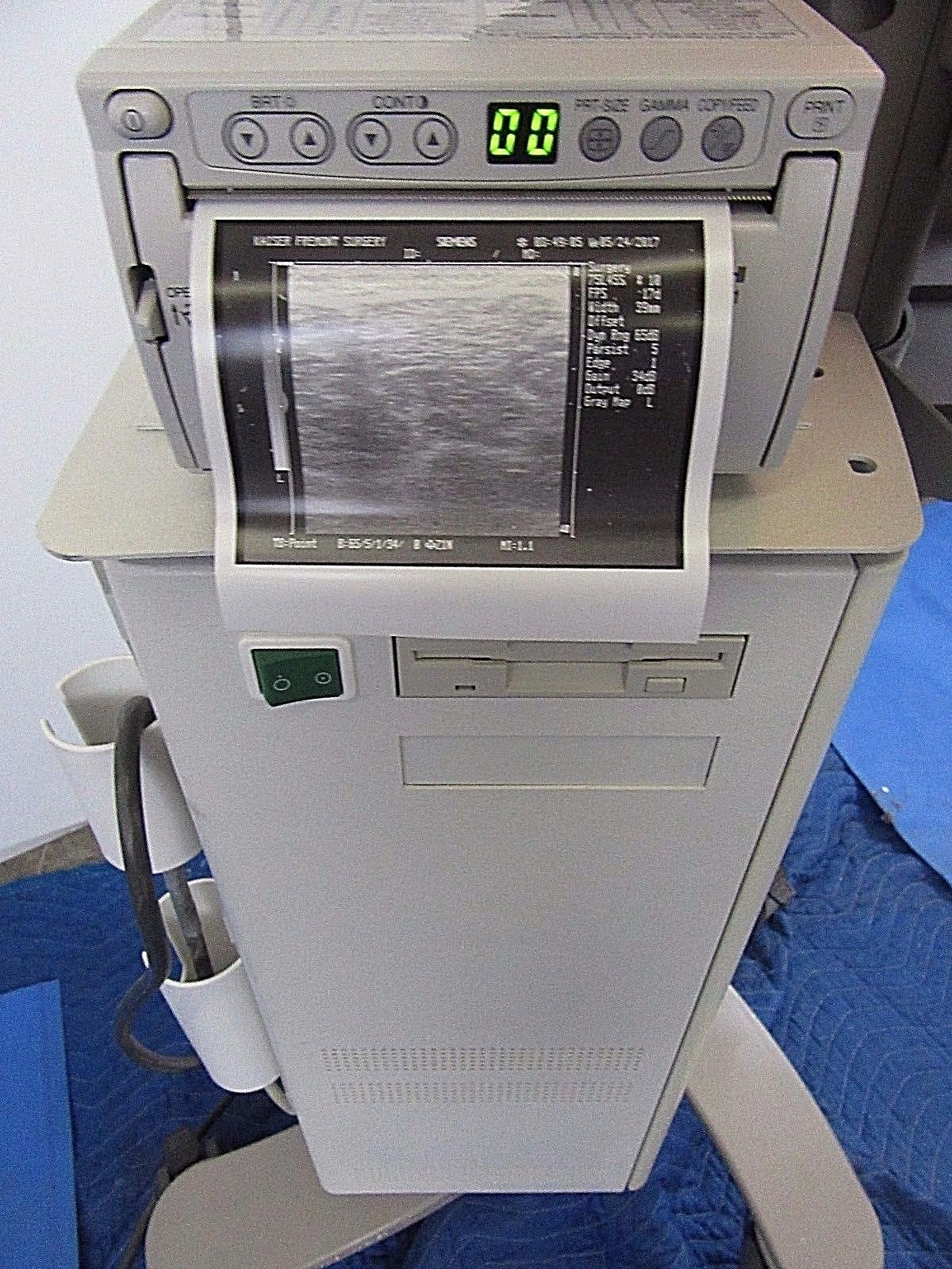 Siemens Sonoline Adara Ultrasound W/7.5L45S Probe & Printer DIAGNOSTIC ULTRASOUND MACHINES FOR SALE