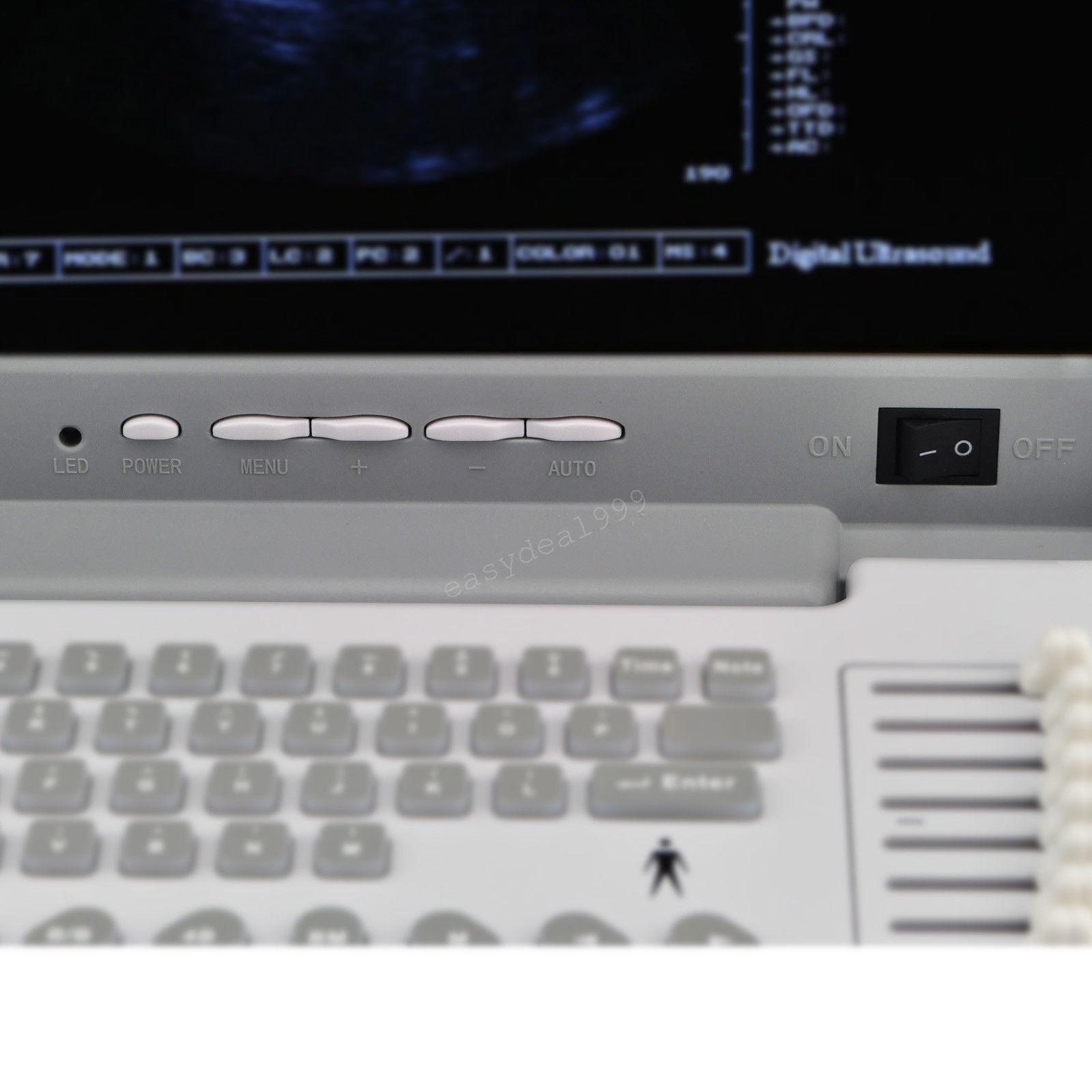 LCD Full Digital Portable Ultrasound Scanner Machine Convex Transvaginal 2 Probe DIAGNOSTIC ULTRASOUND MACHINES FOR SALE