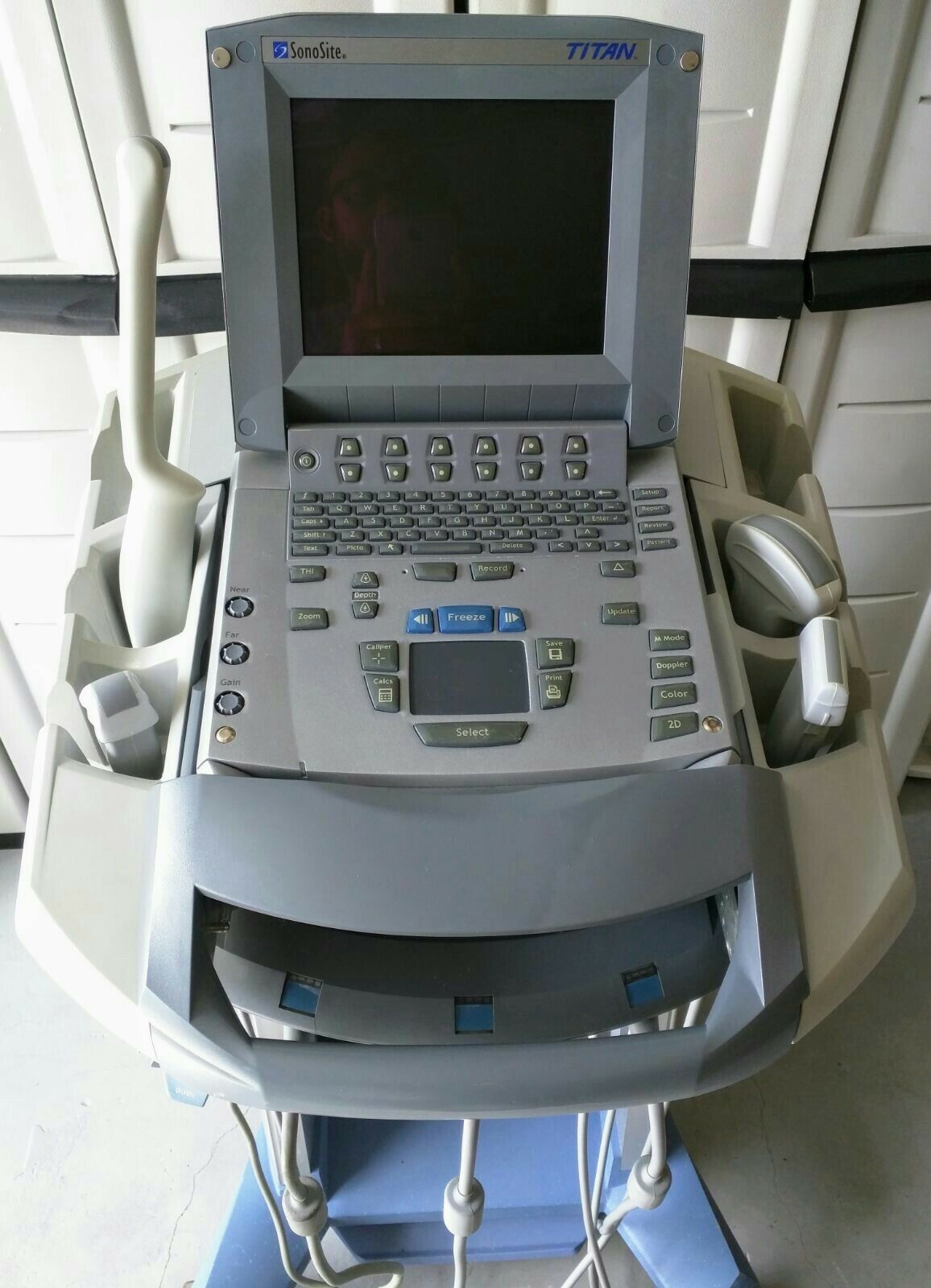 SONOSITE TITAN CW PW PORTABLE ULTRASOUND W/ 4 TRANSDUCERS C15 L38 C60 ICT DIAGNOSTIC ULTRASOUND MACHINES FOR SALE