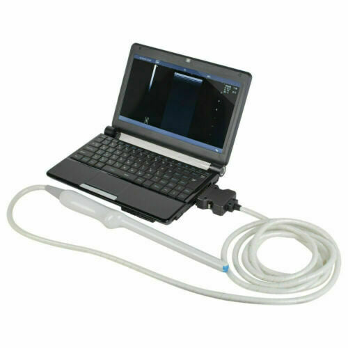 Laptop Ultrasound Scanner Machine+Transvaginal Probe+Micro Convex Probe ON SALE DIAGNOSTIC ULTRASOUND MACHINES FOR SALE