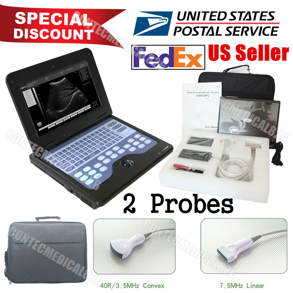 USA,Laptop Ultrasound Scanner Machine with 3.5Mhz Convex+7.5Mhz Linear Probes,CE DIAGNOSTIC ULTRASOUND MACHINES FOR SALE