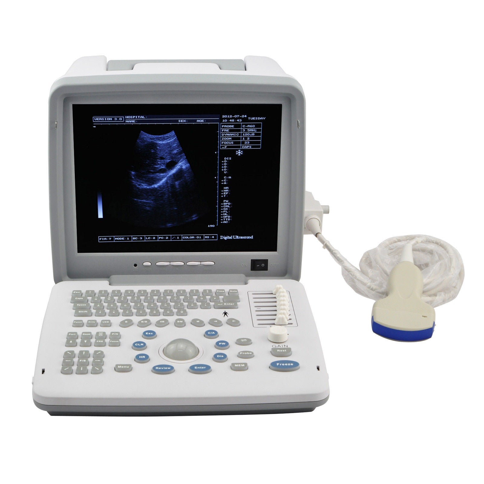 Digital Ultrasound Scanner Machine Convex/Linear/Transvaginal 3 Probes UPS DIAGNOSTIC ULTRASOUND MACHINES FOR SALE