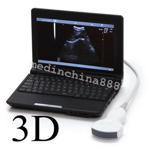 Ultrasound Scanner Equip Convex N Trans-vaginal Probe N Recorder/Printer Sale DIAGNOSTIC ULTRASOUND MACHINES FOR SALE