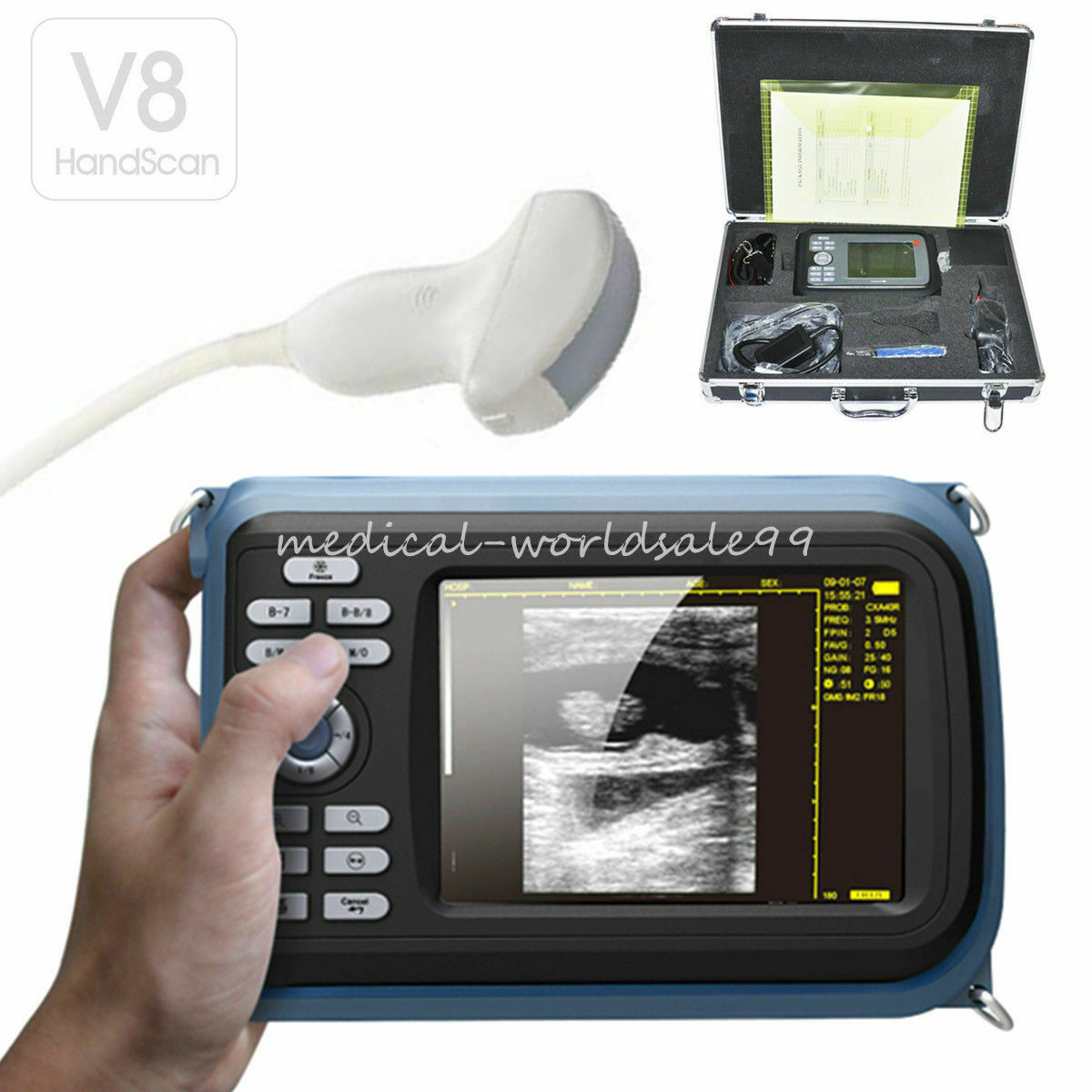 5.5inch Portable Ultrasound Scanner/Machine Digital+Convex Transducer Human Use DIAGNOSTIC ULTRASOUND MACHINES FOR SALE