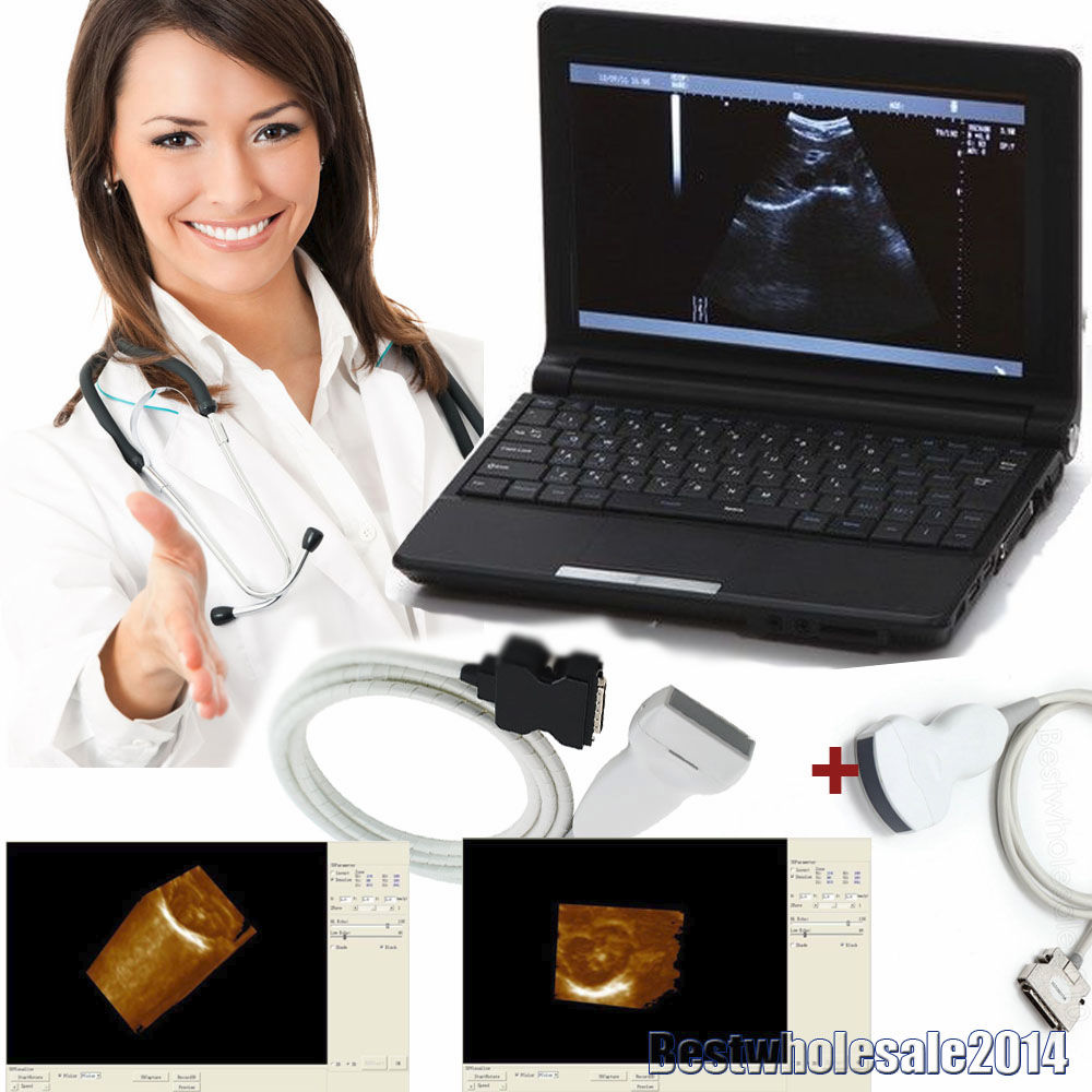 Laptop Ultrasound Scanner  Convex & Linear + 3D 2 Probes USB Port Free 3D DIAGNOSTIC ULTRASOUND MACHINES FOR SALE