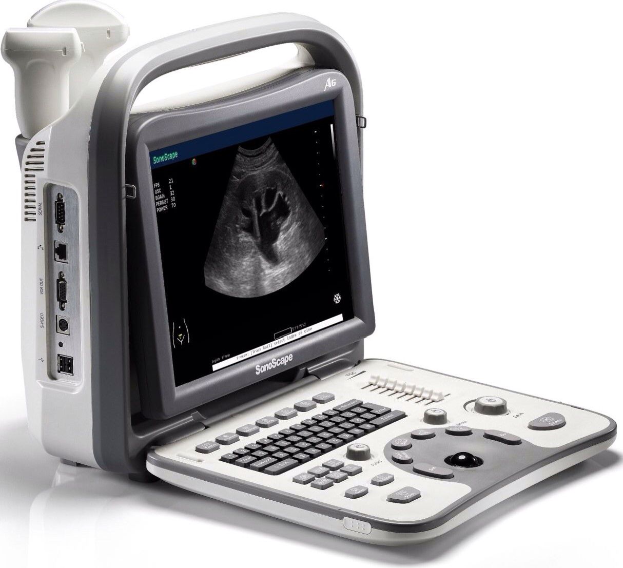 Ultrasound Machine Sonoscape A6 | Includes One Probe of choice,Trolley,Bag,DICOM DIAGNOSTIC ULTRASOUND MACHINES FOR SALE