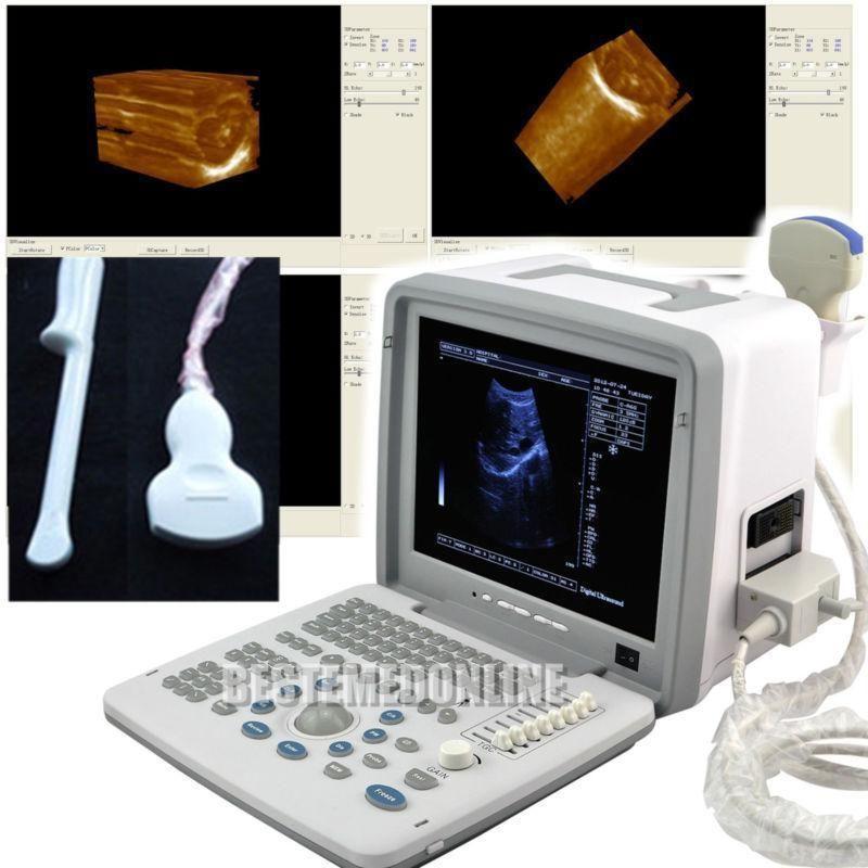 Digital Ultrasound Scanner Convex Transvaginal Probe +3D Ultrasound Equipment 190891416810 DIAGNOSTIC ULTRASOUND MACHINES FOR SALE