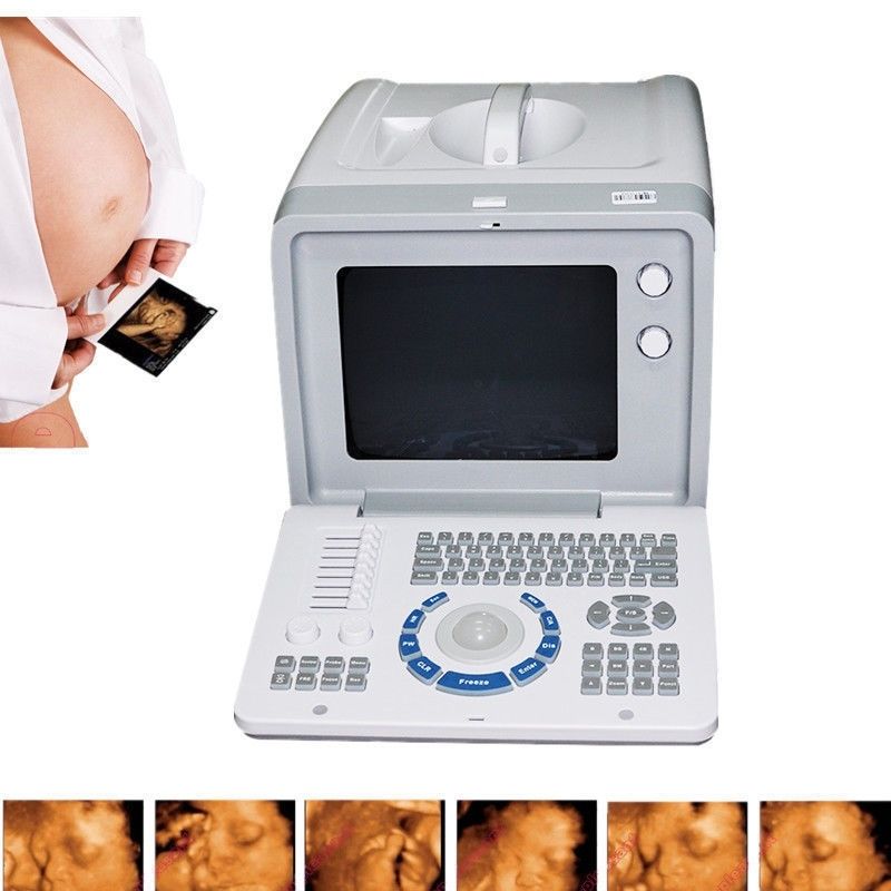 Portable Digital Ultrasound Scanner Ultrasonic System+Convex +Linear 2 Probes 3D DIAGNOSTIC ULTRASOUND MACHINES FOR SALE