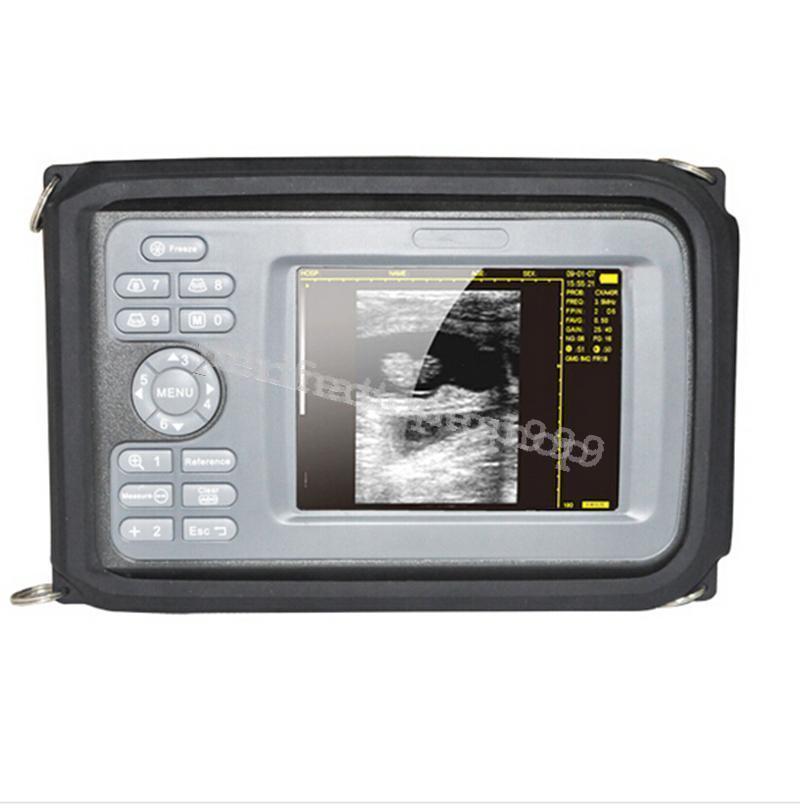 5.5 inch Ultrasound Machine Scanner 3.5 Mhz Convex +7.5Mhz Linear Probe   Human DIAGNOSTIC ULTRASOUND MACHINES FOR SALE