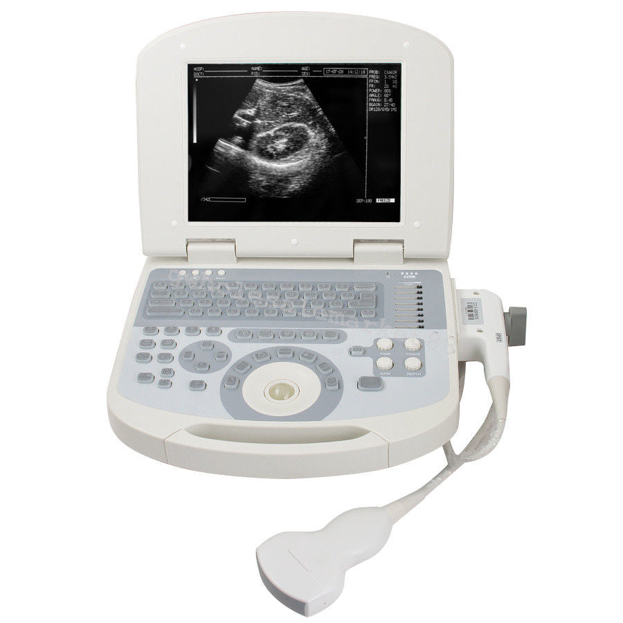 US Hot Portable Ultrasound Machine Scanner System Convex probe 3D Software Image 190891045898 DIAGNOSTIC ULTRASOUND MACHINES FOR SALE