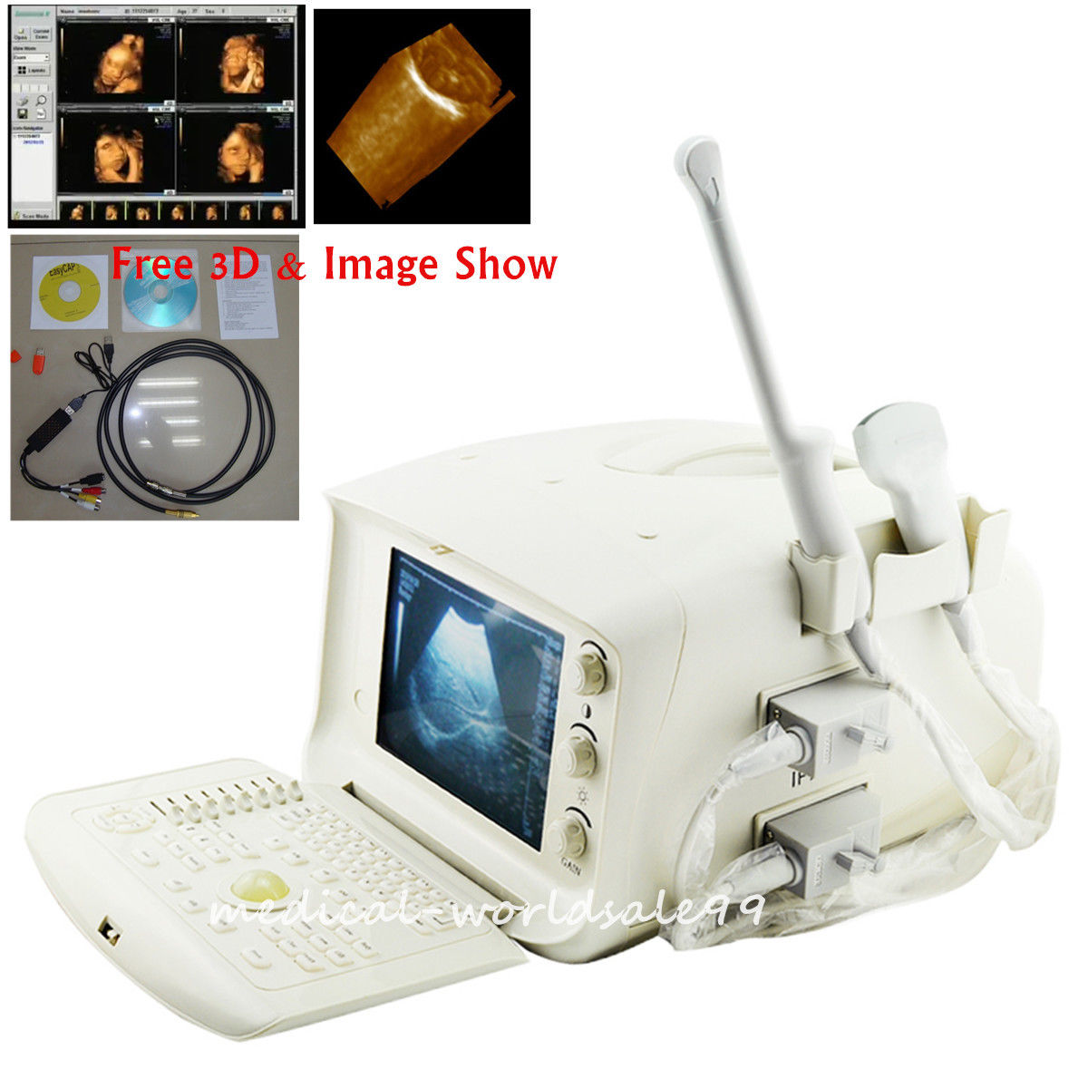 Full 3D Digital Ultrasonic Ultrasound Scanner machine Convex +Transvaginal Probe 190891404527 DIAGNOSTIC ULTRASOUND MACHINES FOR SALE