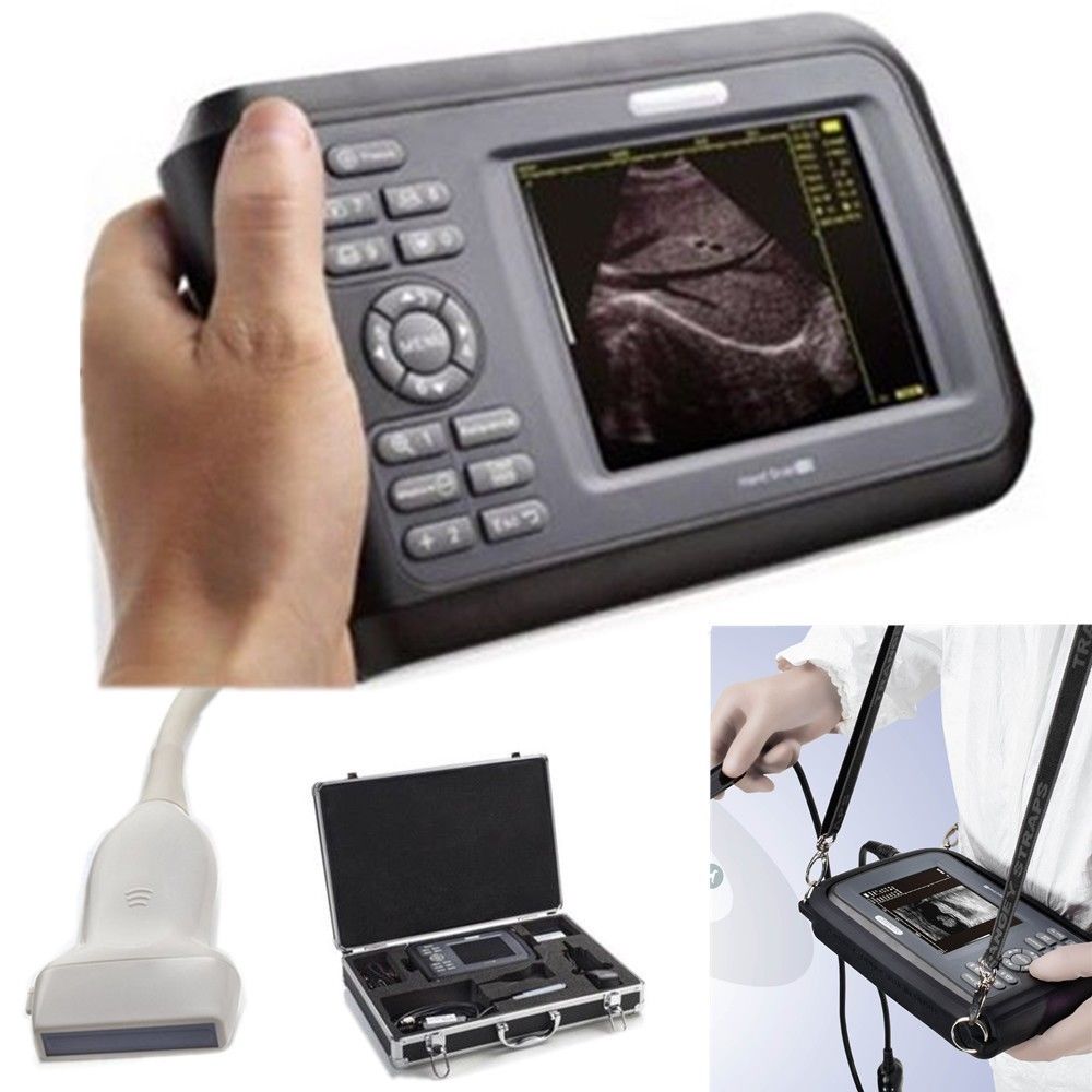 Laptop HandScan Digital Ultrasound machine Scanner system 7.5Mhz HF linear Probe 190891758767 DIAGNOSTIC ULTRASOUND MACHINES FOR SALE