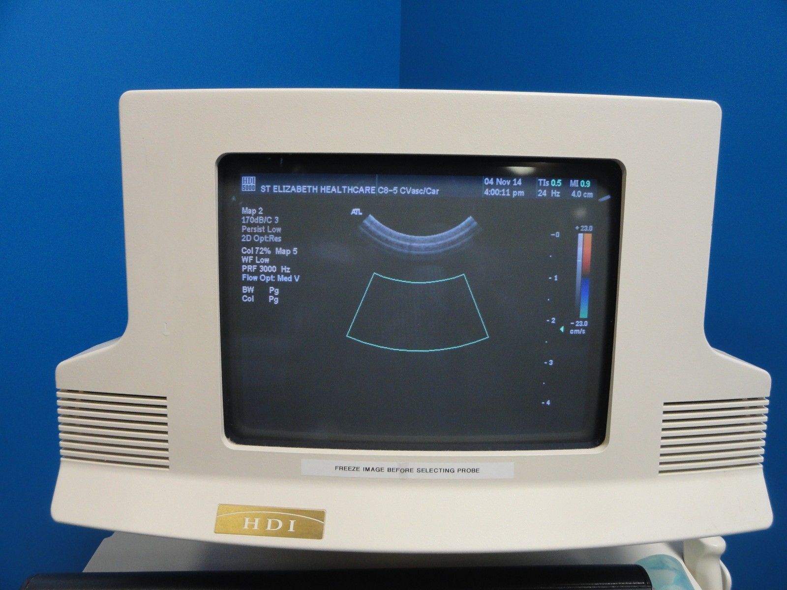 ATL C8-5 14R Micro-Convex Small Parts CVS PVS MSK Peads & OB Probe (8263) DIAGNOSTIC ULTRASOUND MACHINES FOR SALE