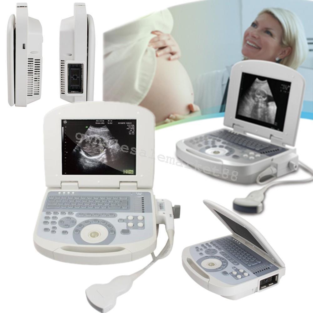 US Notebook Ultrasound Machine Scanner System Convex Probe +3D Software Portable 190891422491 DIAGNOSTIC ULTRASOUND MACHINES FOR SALE