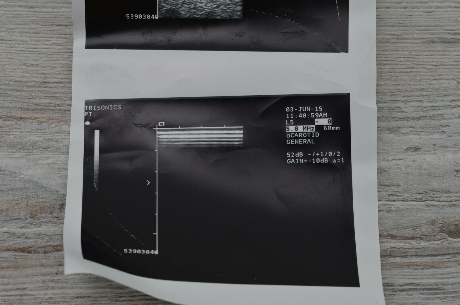 Acuson 5 Needle Guide L5 Model No. 08245443 Ultrasound Probe DIAGNOSTIC ULTRASOUND MACHINES FOR SALE