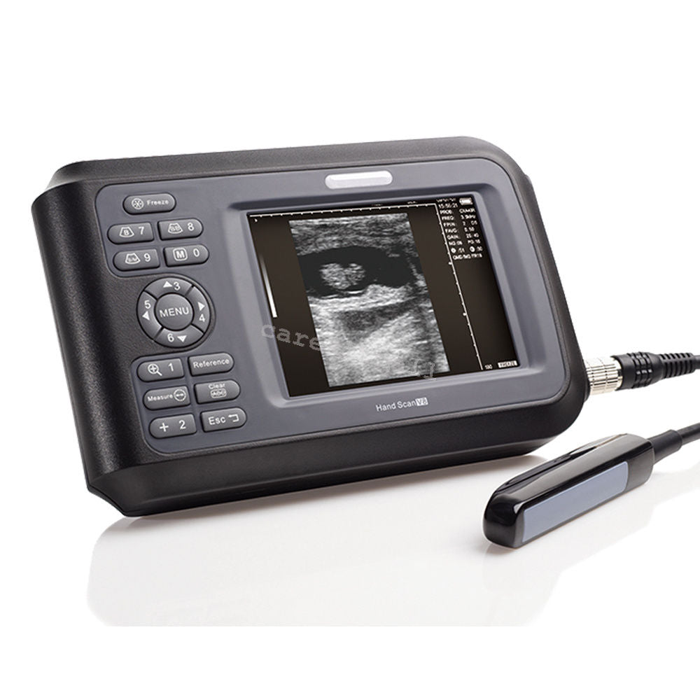 Veterinary Portable Digital Ultrasound Scanner System,Rectal Probe,Rose Oximeter DIAGNOSTIC ULTRASOUND MACHINES FOR SALE