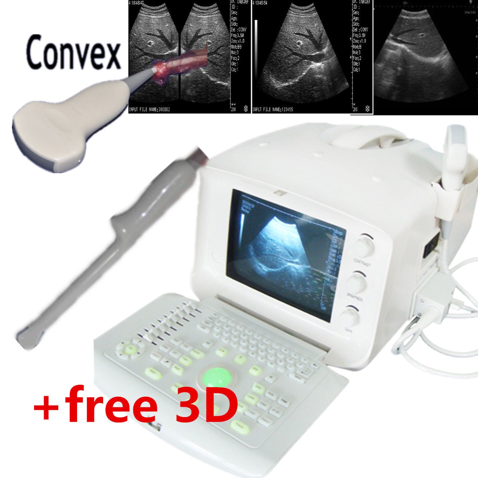 Convex Probe & Transvaginal Probe Digital Portable Ultrasound Scanner 3D FREE DIAGNOSTIC ULTRASOUND MACHINES FOR SALE