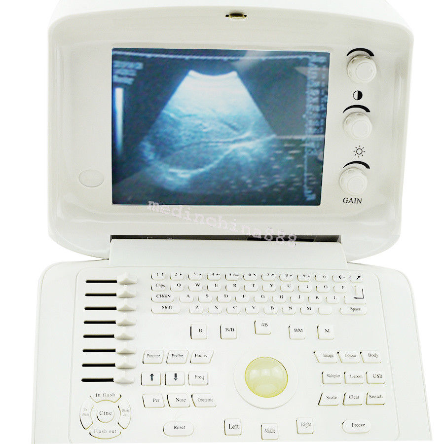 Portable Ultrasound Scanner Machine With convex N Linear Probe N 3D Image CE 190891263667 DIAGNOSTIC ULTRASOUND MACHINES FOR SALE