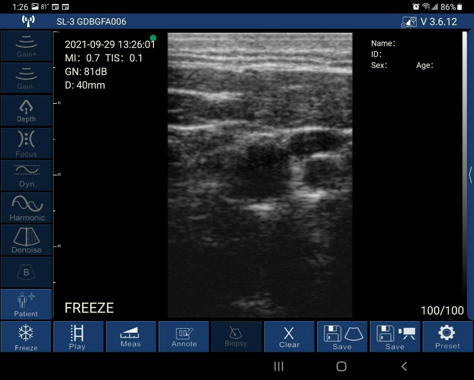 Sonostar Portable Wireless Ultrasound 7.5 MHz Linear Probe DIAGNOSTIC ULTRASOUND MACHINES FOR SALE