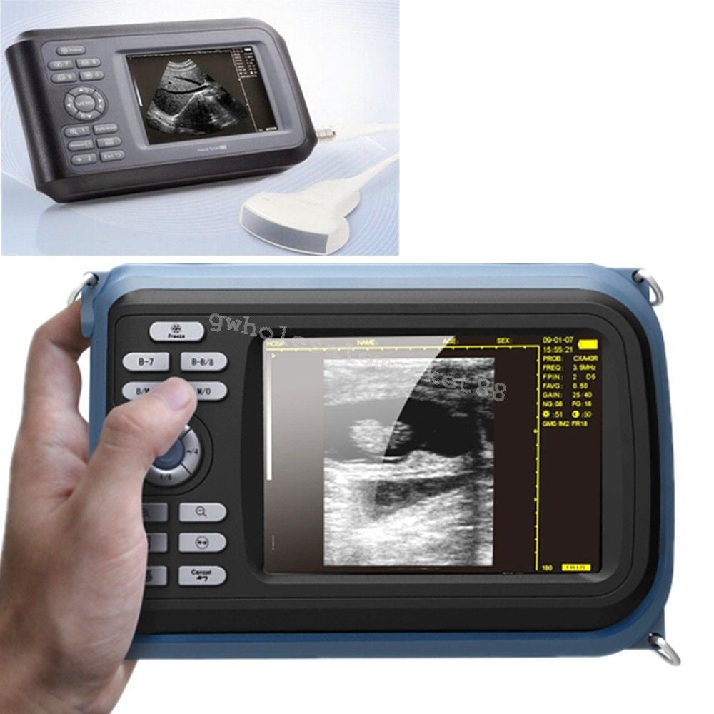 Laptop Machine Scan Digital Ultrasound Scanner Convex Linear Transvaginal Probe DIAGNOSTIC ULTRASOUND MACHINES FOR SALE