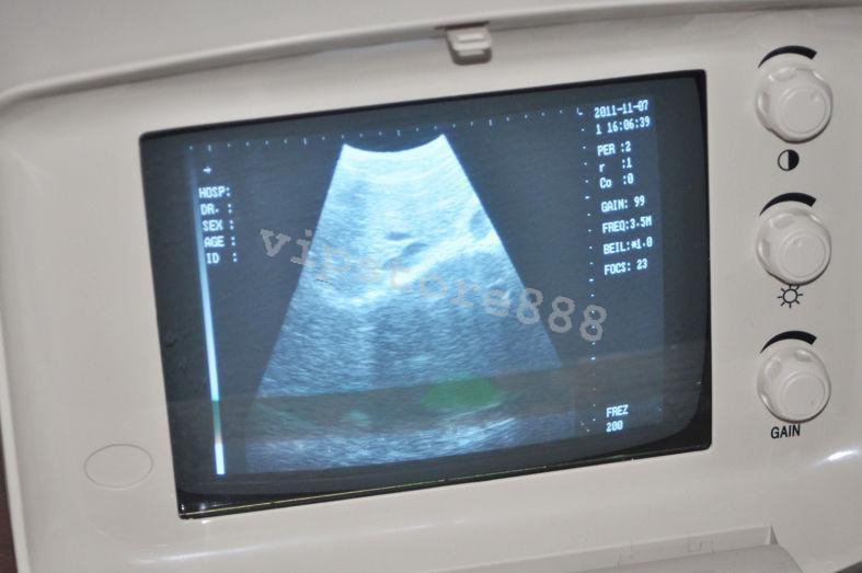 Convex Probe &Transvaginal 2 Probes Digital Portable Ultrasound Scanner +Free 3D DIAGNOSTIC ULTRASOUND MACHINES FOR SALE