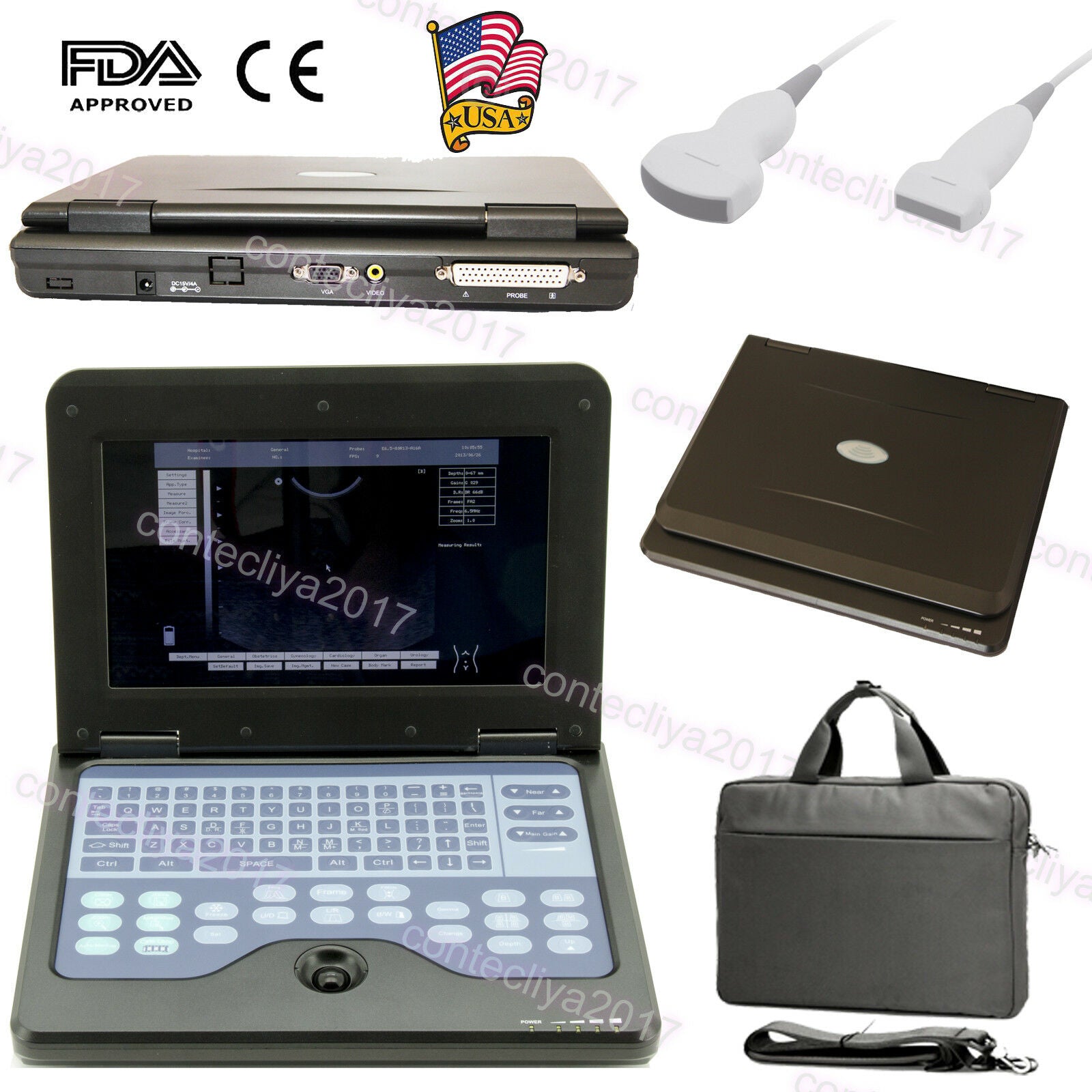 USA Ultrasound Scanner Laptop Diagnostic Ultrasonic Systems Convex+Linear Probe DIAGNOSTIC ULTRASOUND MACHINES FOR SALE