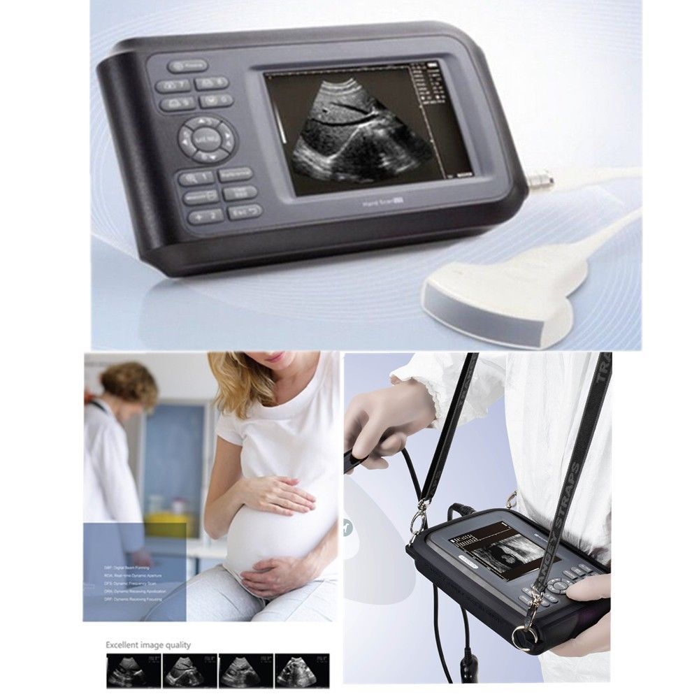 CE Factory Medical Ultrasound Scanner Machine Convex Probe Abdominal +Oximeter 190891827272 DIAGNOSTIC ULTRASOUND MACHINES FOR SALE