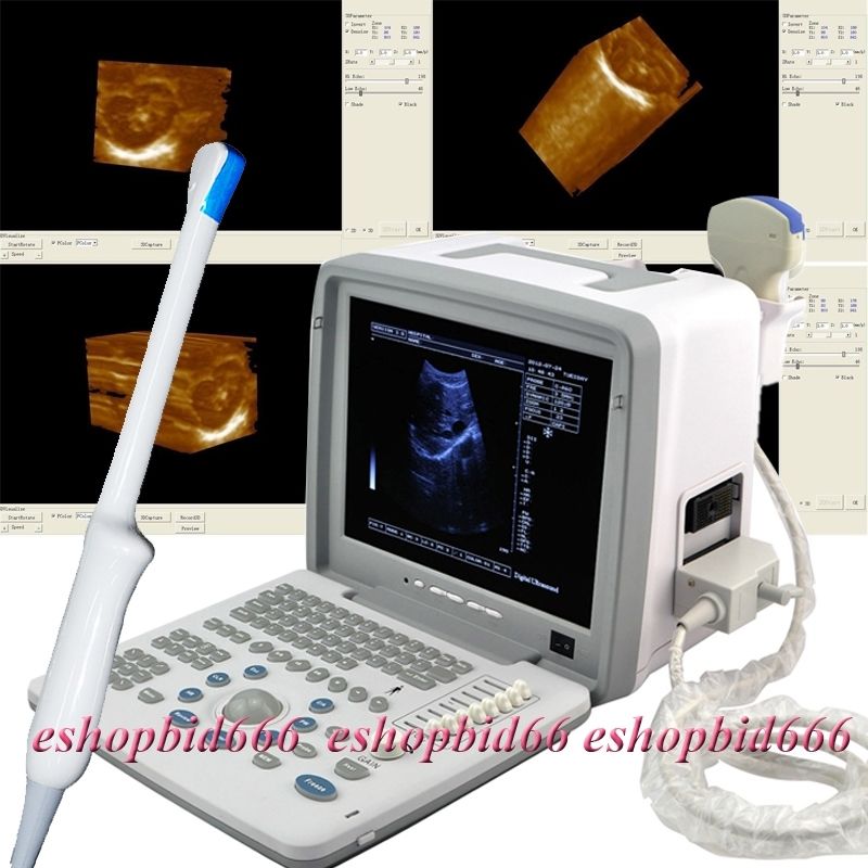 CE LED Digital Portable Ultrasound Scanner abdominal Convex+transvaginal 2 Probe DIAGNOSTIC ULTRASOUND MACHINES FOR SALE