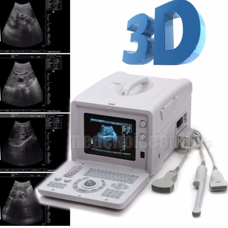 Excellent 10"Digital Ultrasound Machine Covex/ Linear/ Transvaginal 3 Probes Kit DIAGNOSTIC ULTRASOUND MACHINES FOR SALE