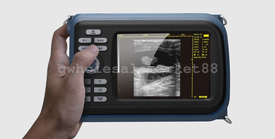 Veterinary Digital Palm Ultrasound Scanner Animal Rectal Probe Battery Case Dogs DIAGNOSTIC ULTRASOUND MACHINES FOR SALE