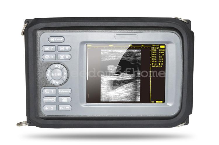 Veterinary Digital Ultrasound Scanner Big Animal Rectal Probe Neck Belt and Case 190891403353 DIAGNOSTIC ULTRASOUND MACHINES FOR SALE