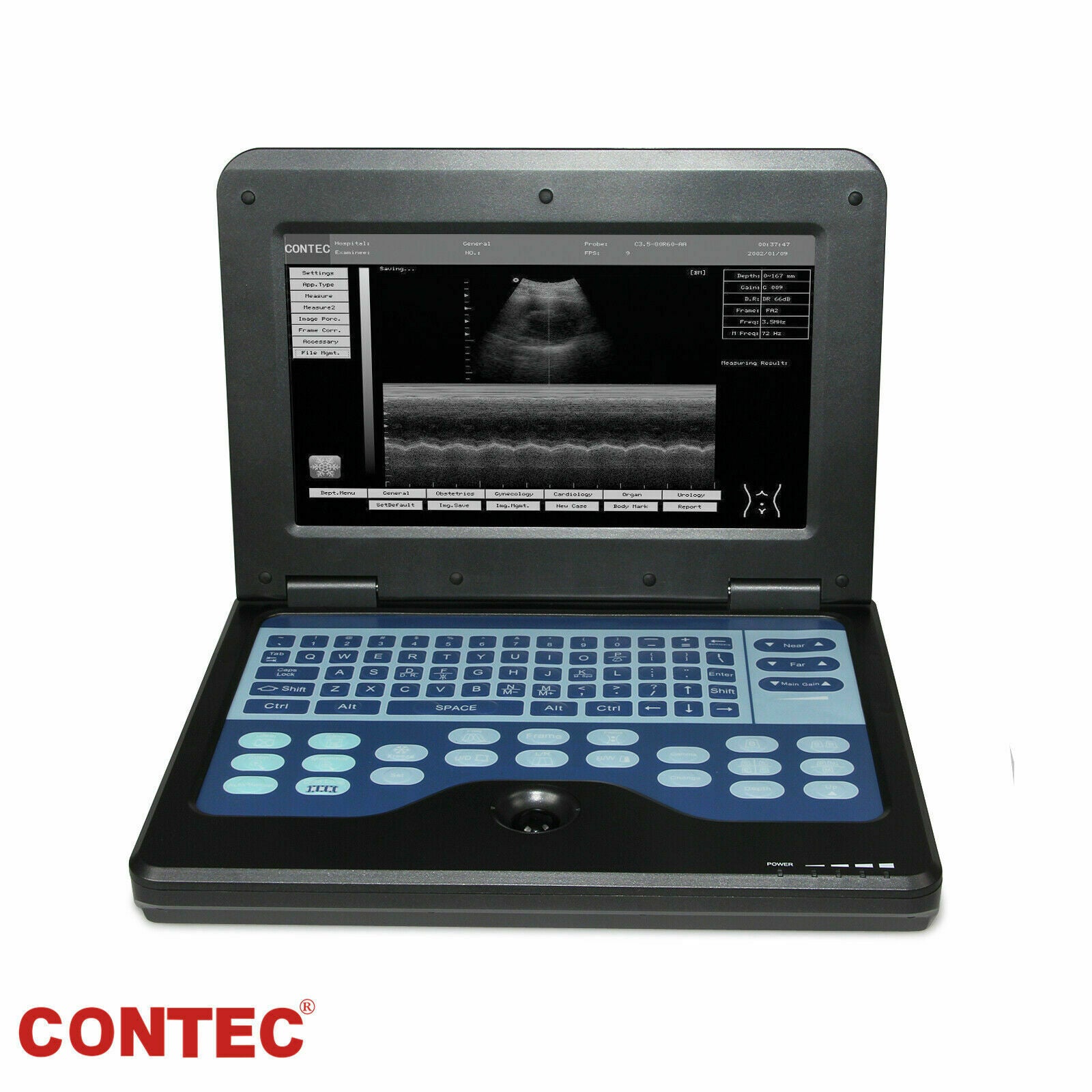 Digital Portable Ultrasound Machine Laptop Scanner with 3.5Mhz Convex Probe CE  6945040100362 DIAGNOSTIC ULTRASOUND MACHINES FOR SALE