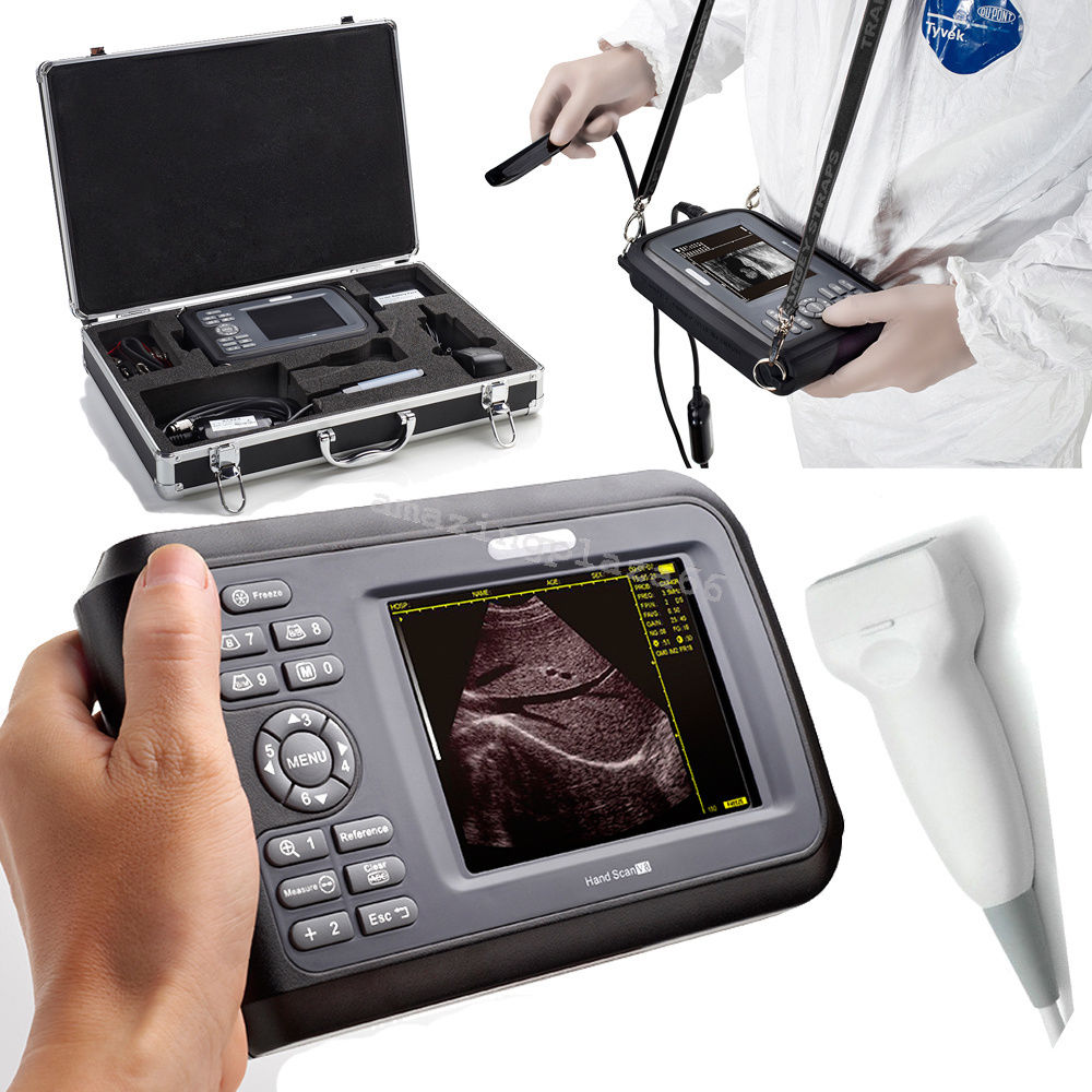 Portable Handheld Digital Ultrasound Scanner Machine+ linear Probe+ Battery DHL DIAGNOSTIC ULTRASOUND MACHINES FOR SALE