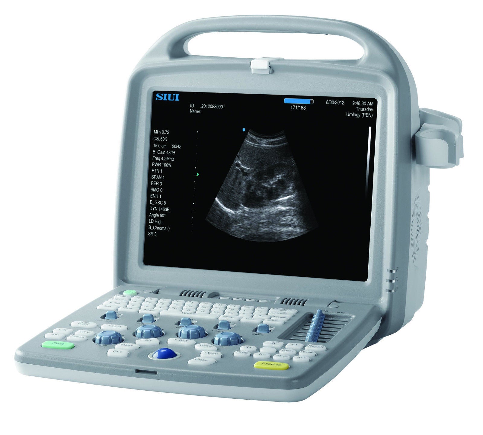 SIUI - 5500 Plus Ultrasound with Convex or Linear Probe DIAGNOSTIC ULTRASOUND MACHINES FOR SALE