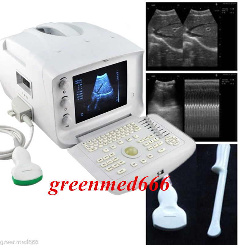 New +3D Digital Ultrasound Scanner +Convex Transvaginal probes 2 probes HD image 190891051066 DIAGNOSTIC ULTRASOUND MACHINES FOR SALE