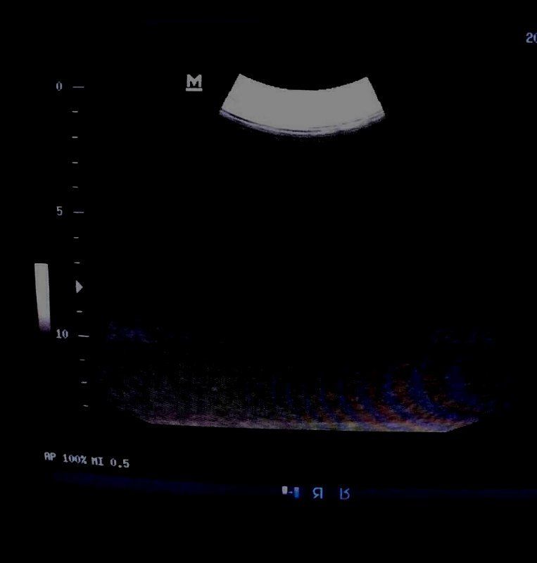 Esaote original used CA541 ultrasound probe good working ultrasound transducer DIAGNOSTIC ULTRASOUND MACHINES FOR SALE