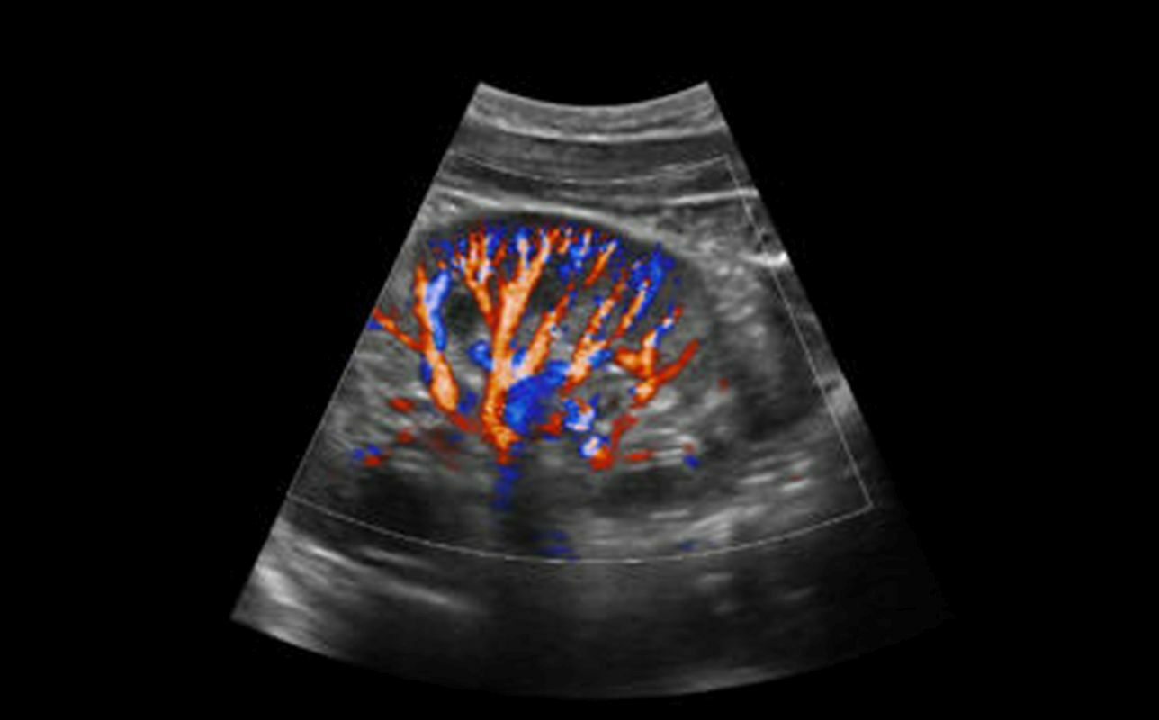 Sonoscape X5 Portable Ultrasound With Linear and Convex probes DIAGNOSTIC ULTRASOUND MACHINES FOR SALE